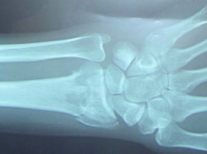 P5250001_2_1.jpg